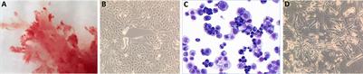 Primary Trophoblast Cultures: Characterization of HLA Profiles and Immune Cell Interactions